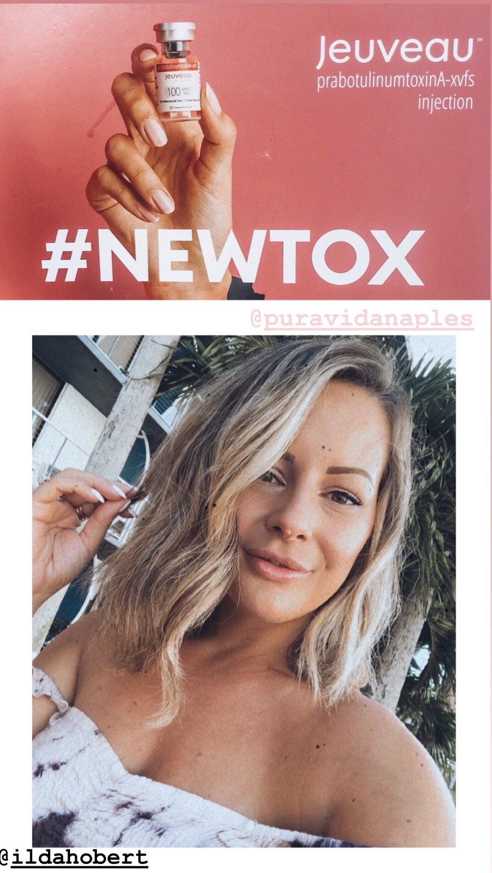 Naples, FL Medical Spa Review - toxins